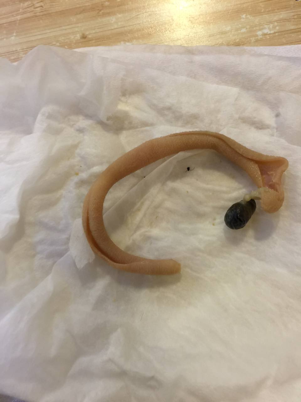 这是一只有结石的鸭子吗?黑色物体是断头小强吗?看着就没胃口了!